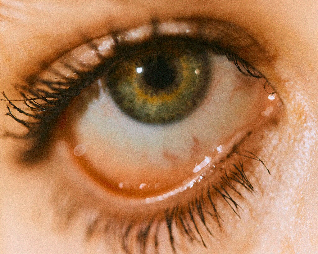 pic